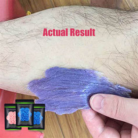 Auperwel hard wax in use on bikini area demonstrating gentle effective hair removal