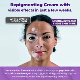AURA VITAMINS ingredient visual highlighting Polypodium leucotomos for antioxidant support