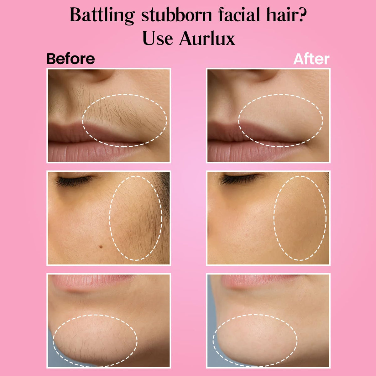 Application demonstration of Aurlux on chin area illustrating easy use and coverage
