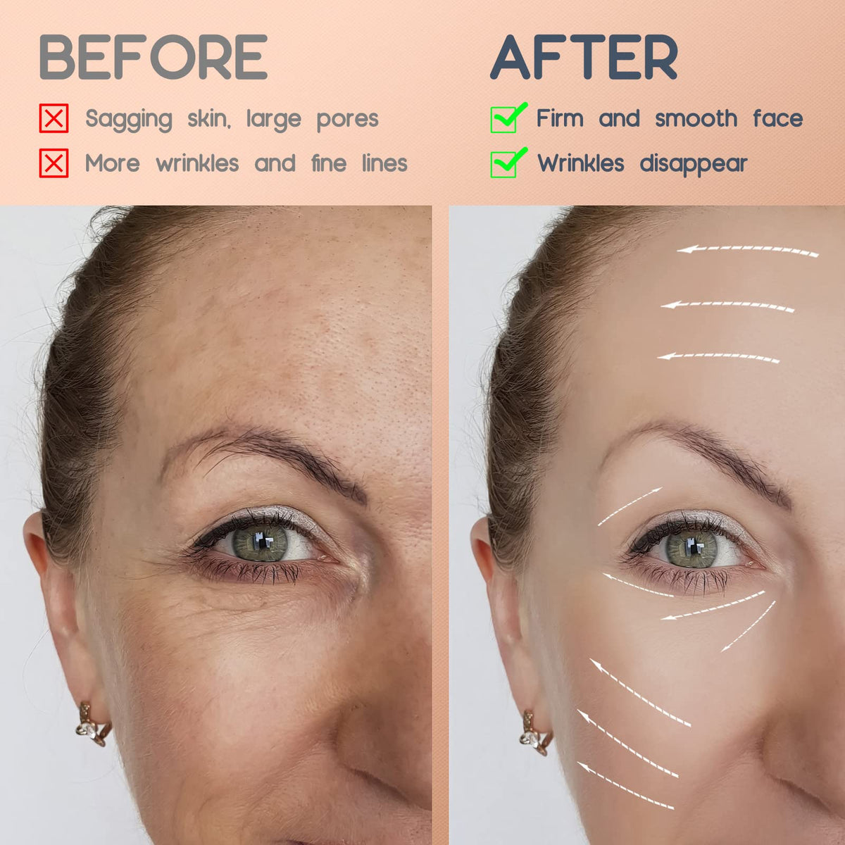 AURUZA on neck demonstrating targeted support for shallow neck lines and firmer appearance