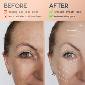 AURUZA on neck demonstrating targeted support for shallow neck lines and firmer appearance