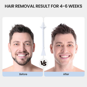 AUZEAL applicator in use inside nostril for precise hair removal