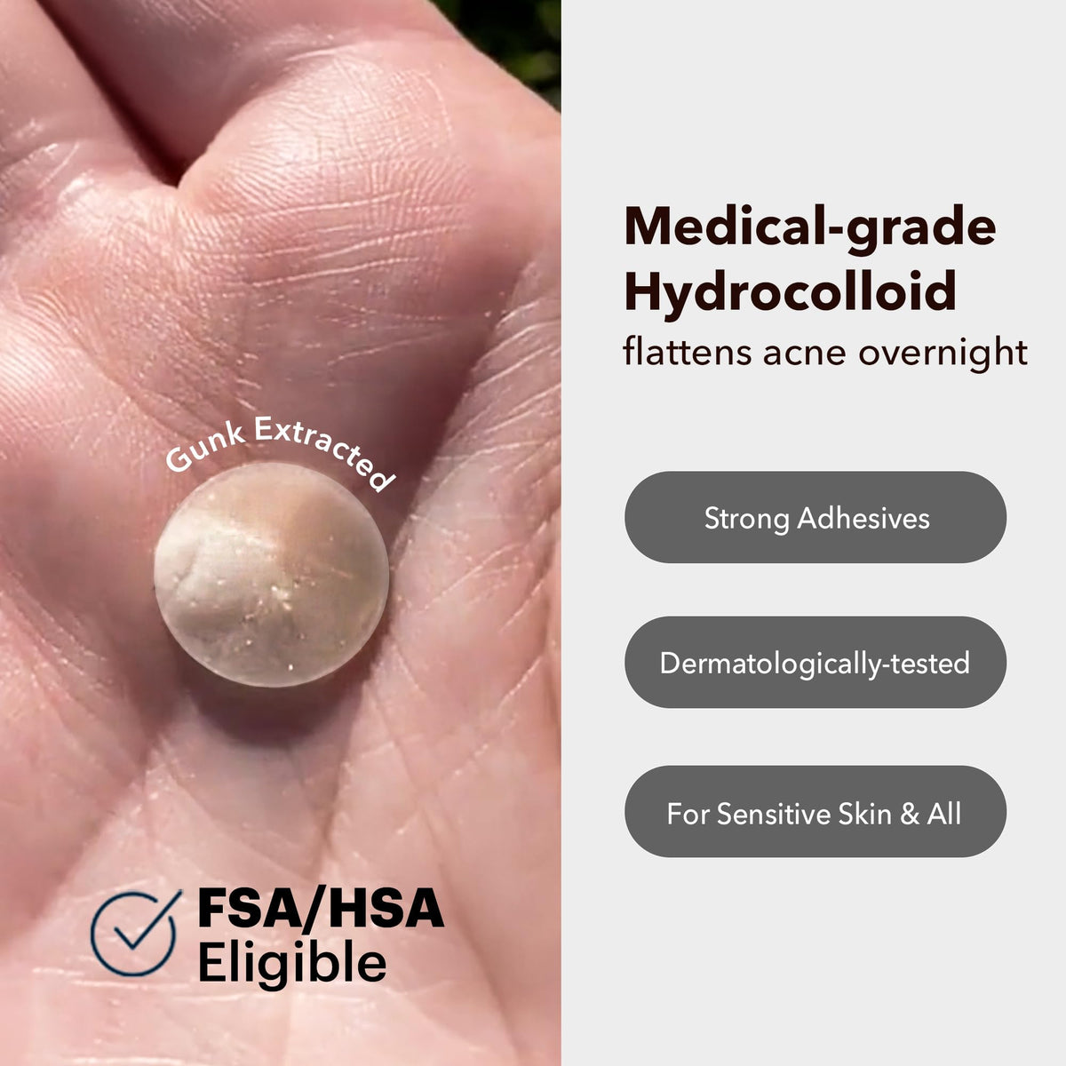 AVARELLE before and after blemish showing visible flattening benefit
