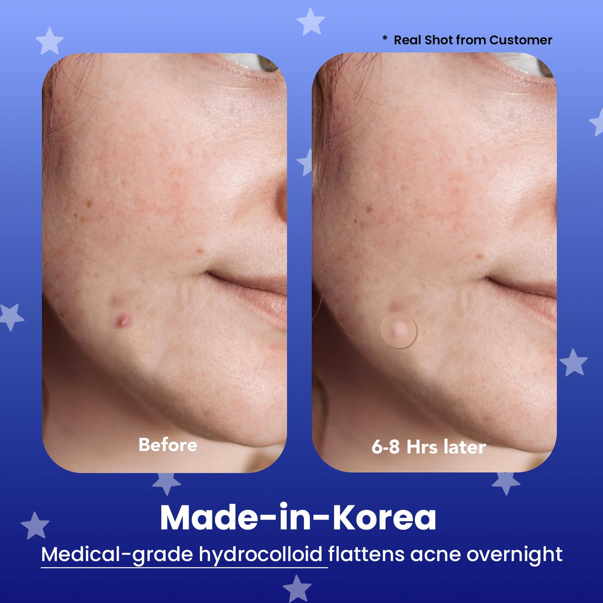 AVARELLE close-up of hydrocolloid texture showing absorbent surface benefit