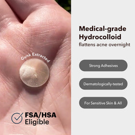 AVARELLE close-up of hydrocolloid patch texture demonstrating thin absorbent layer benefit