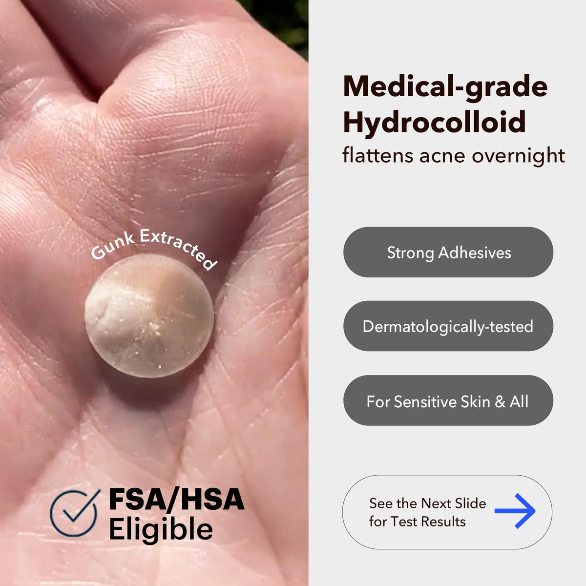 AVARELLE close-up of hydrocolloid patch texture showing thin finish