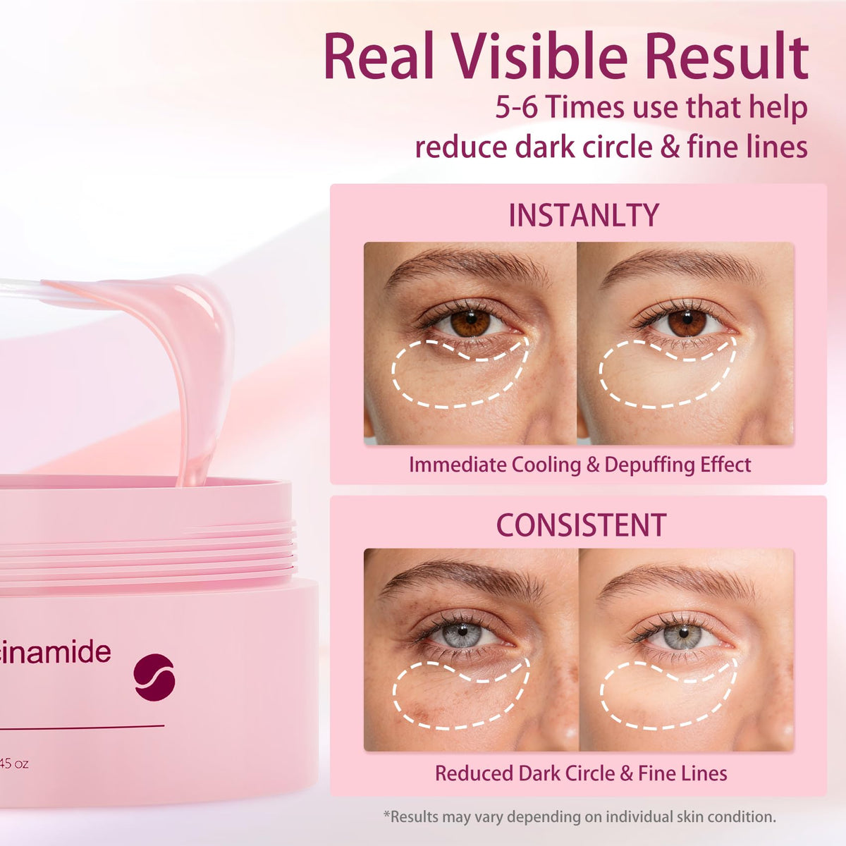 AveCera patches applied under eye on model demonstrating de-puffing benefit