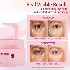 AveCera patches applied under eye on model demonstrating de-puffing benefit