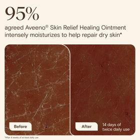 Aveeno applied to lips close-up, soothing chapped lips and locking hydration