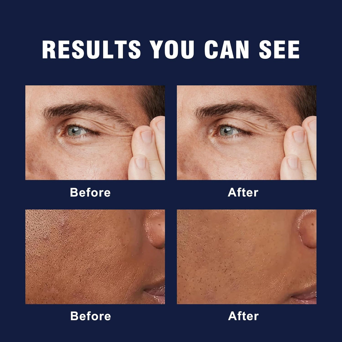 AVITAPURE application on a man's hand showing easy spread and non-greasy finish