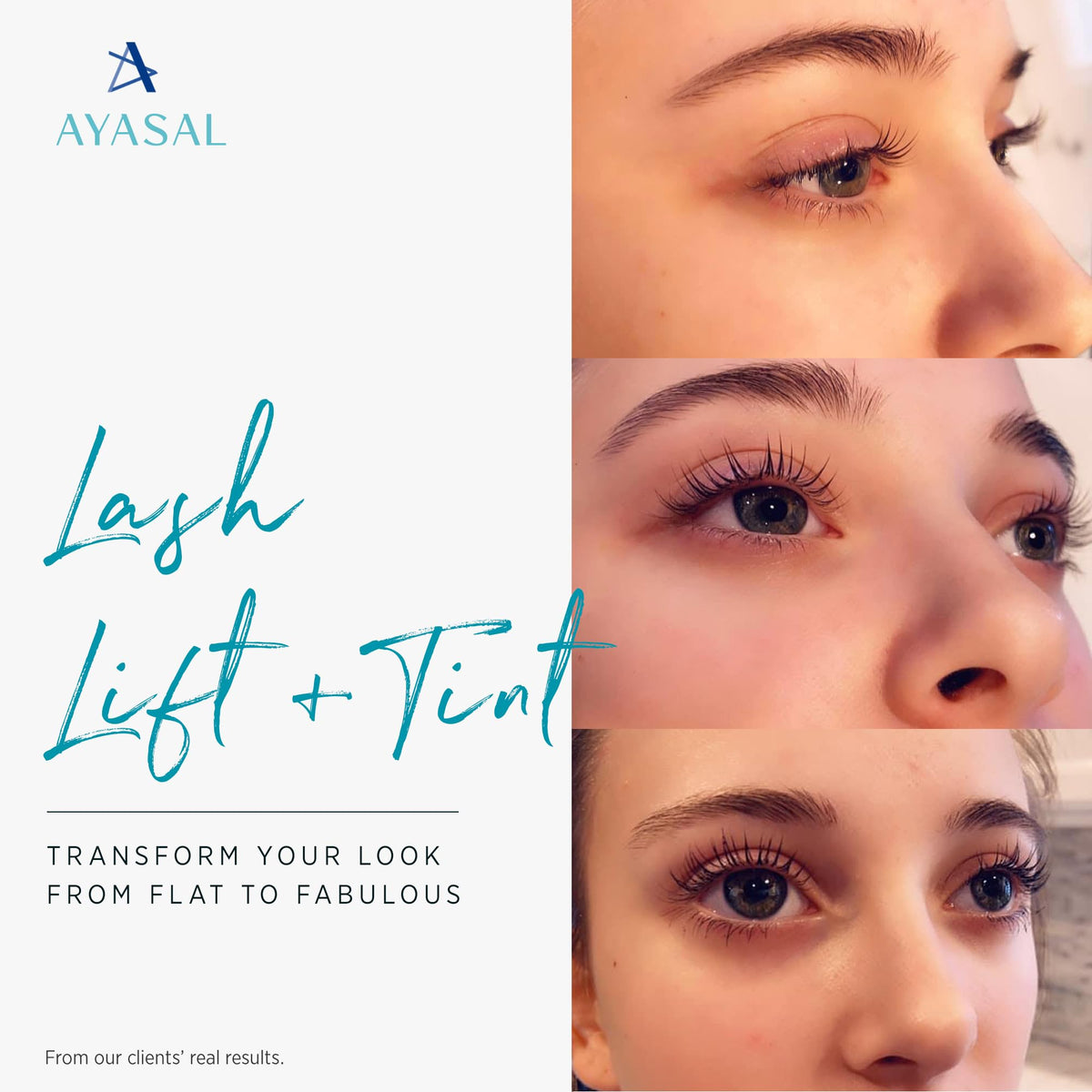 AYASAL single-use step pouches emphasizing hygiene and freshness