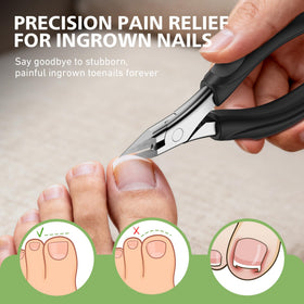 Baluca close-up of ultra-slim blade tip showing precision for ingrown nail trimming