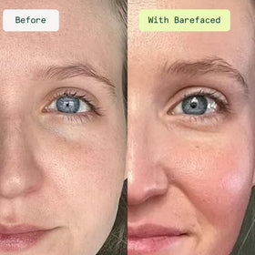 Barefaced ingredients highlight niacinamide and hyaluronic acid benefits