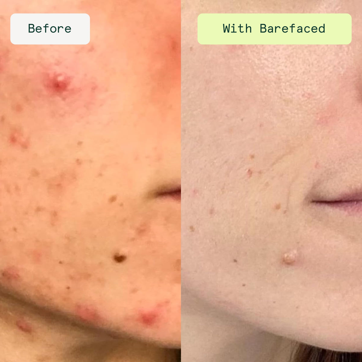 Barefaced pad texture close-up highlighting exfoliating cloth fibers for effective resurfacing
