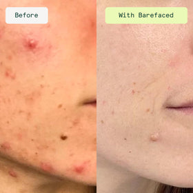 Barefaced pad texture close-up highlighting exfoliating cloth fibers for effective resurfacing