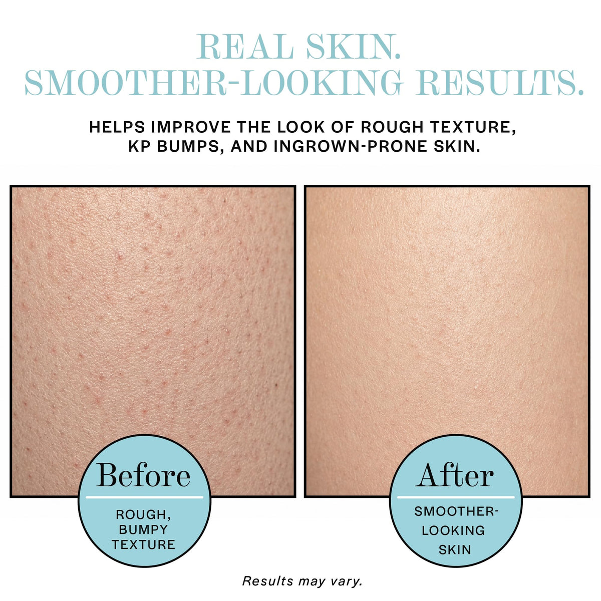 BASE LABORATORIES gentle application to bikini area soothing irritation