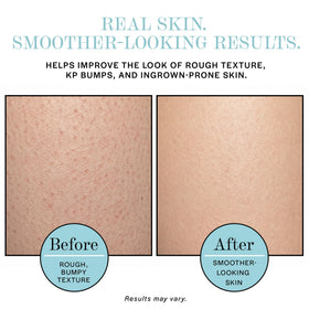 BASE LABORATORIES gentle application to bikini area soothing irritation