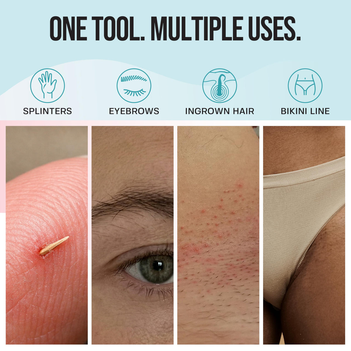 BASE LABORATORIES curved tip close-up showing gentle scoop design to lift ingrown hairs