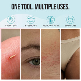 BASE LABORATORIES curved tip close-up showing gentle scoop design to lift ingrown hairs