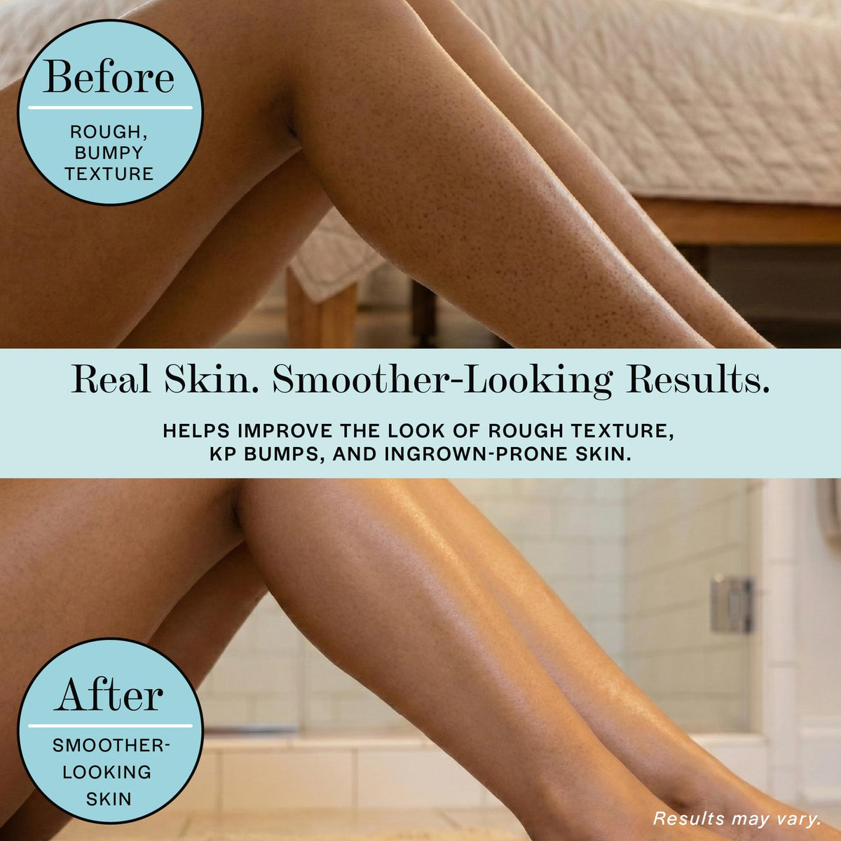 BASE LABORATORIES applied to leg in shower reducing strawberry skin