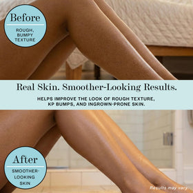 BASE LABORATORIES applied to leg in shower reducing strawberry skin