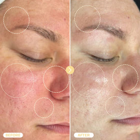 BASE LABORATORIES in use on face to soothe redness and irritation