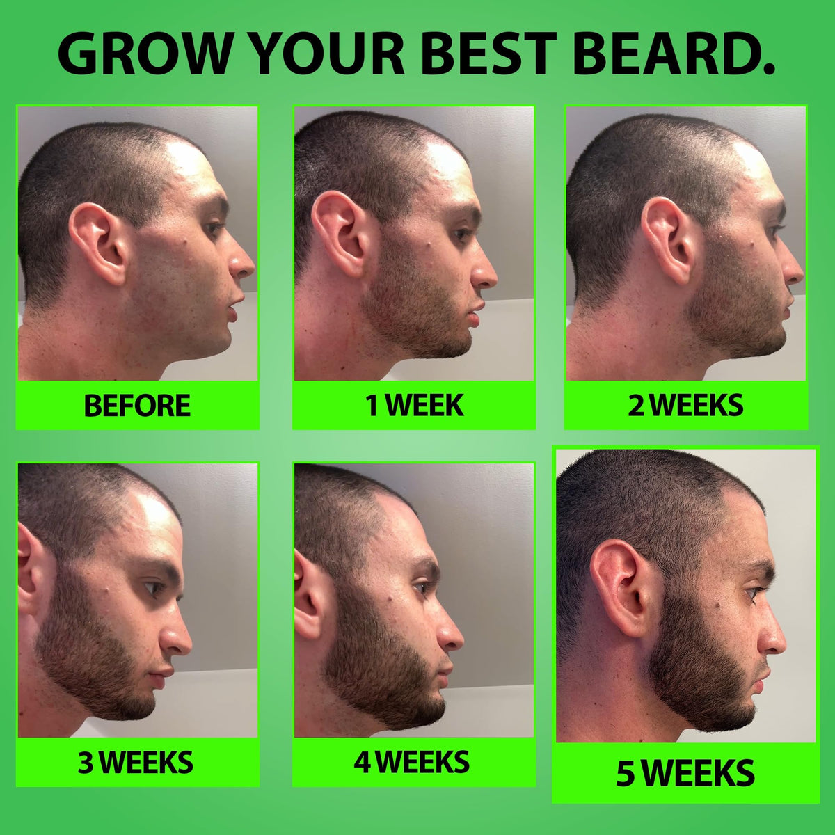 BBS BEST BEARD STUFF applying spray to a patchy cheek area to help target sparse facial hair growth