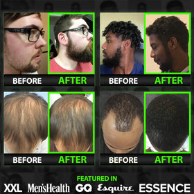 BBS BEST BEARD STUFF scalp application with finger massage showing improved circulation benefit