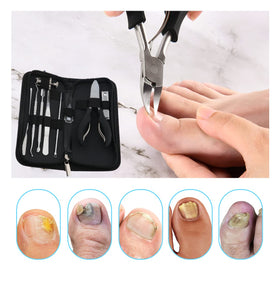Bcabo toenail corrector closeup highlighting lever mechanism for controlled nail reshaping