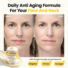 Bealions cream applied to neck demonstrating targeted anti-aging care