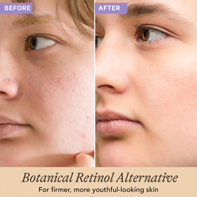 Beauty by Earth dropper dispensing serum illustrating precise application and control
