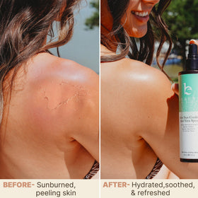 Beauty by Earth mist spraying to deliver quick, no-rub relief