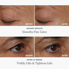 Beekman 1802 serum application on upper lid demonstrating safe precise targeted use