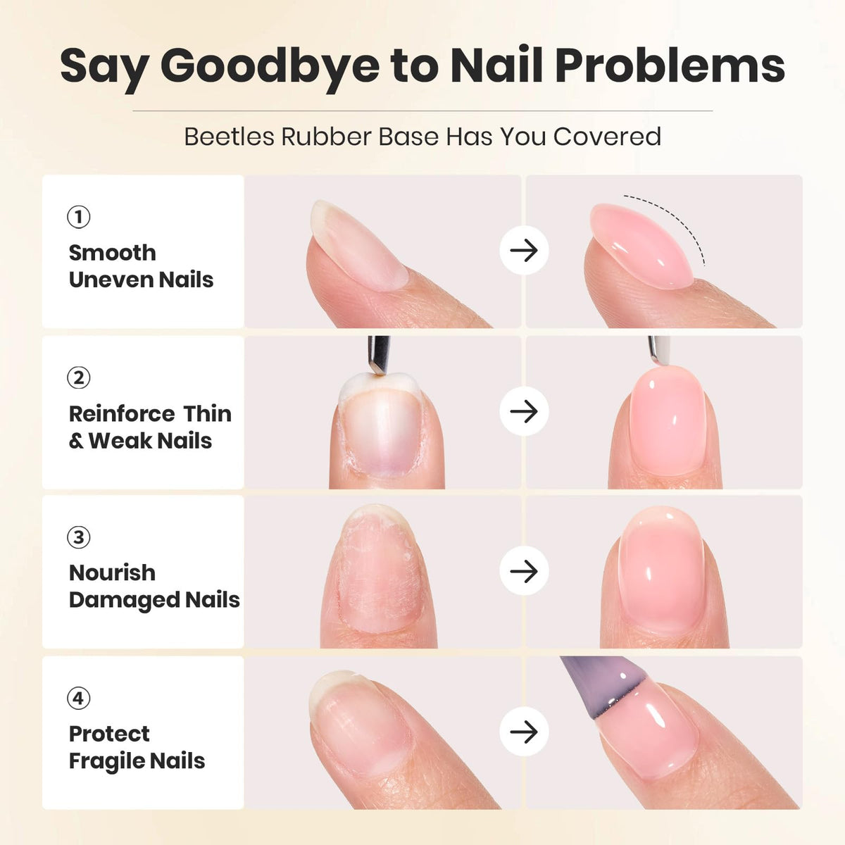 beetles gel applied on finger with sculpted arch for support
