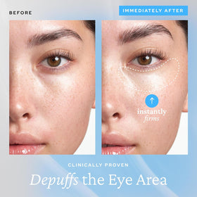 belif ceramic tip close-up providing cooling application for soothing under-eyes