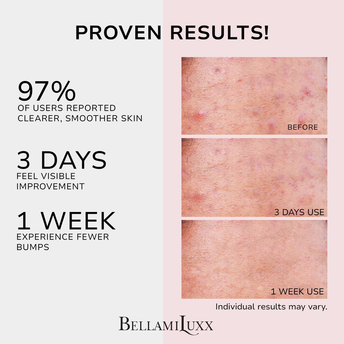 BellamiLuxx cream texture close-up highlighting lightweight absorption benefit