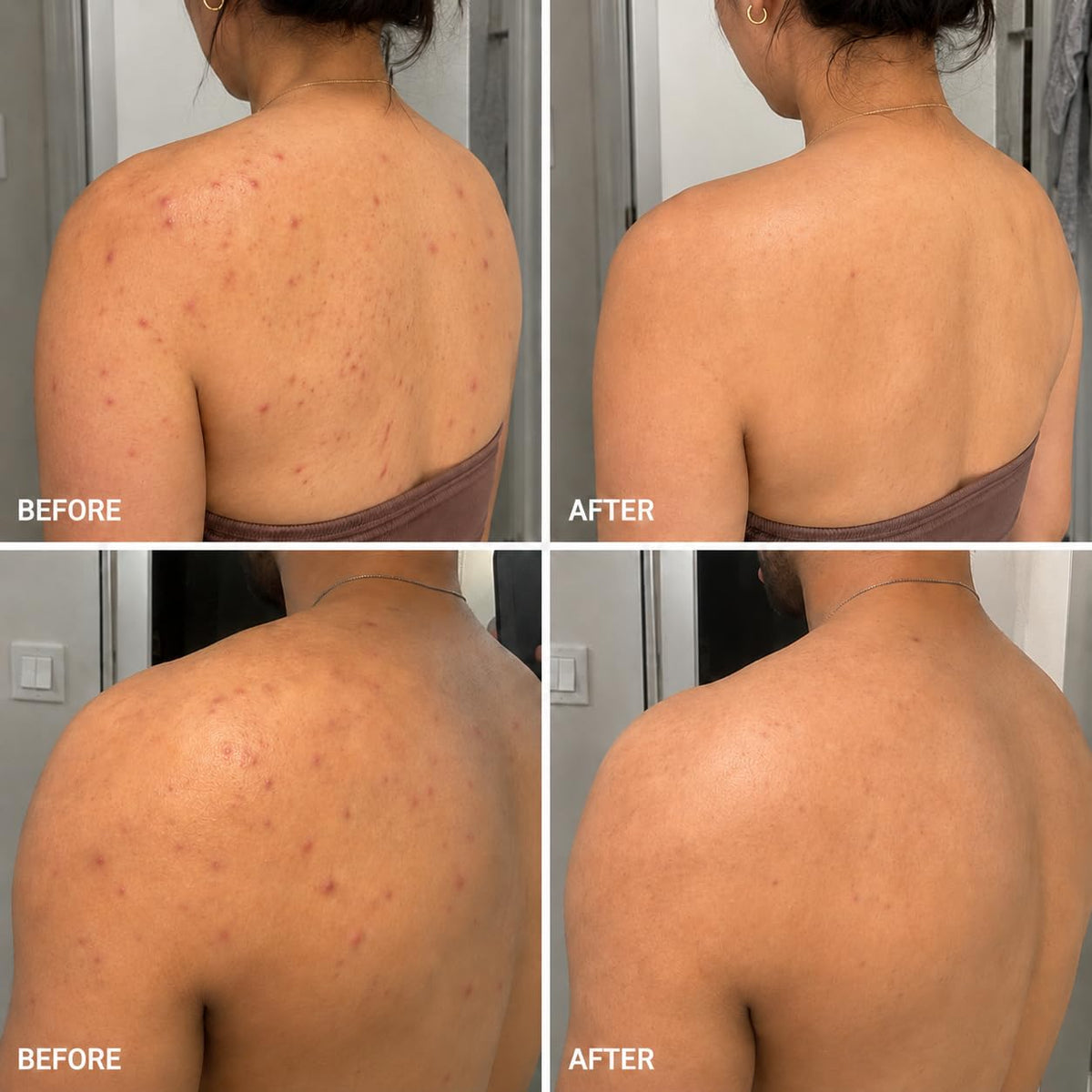 BellamiLuxx being used on back in shower to reduce bacne bumps