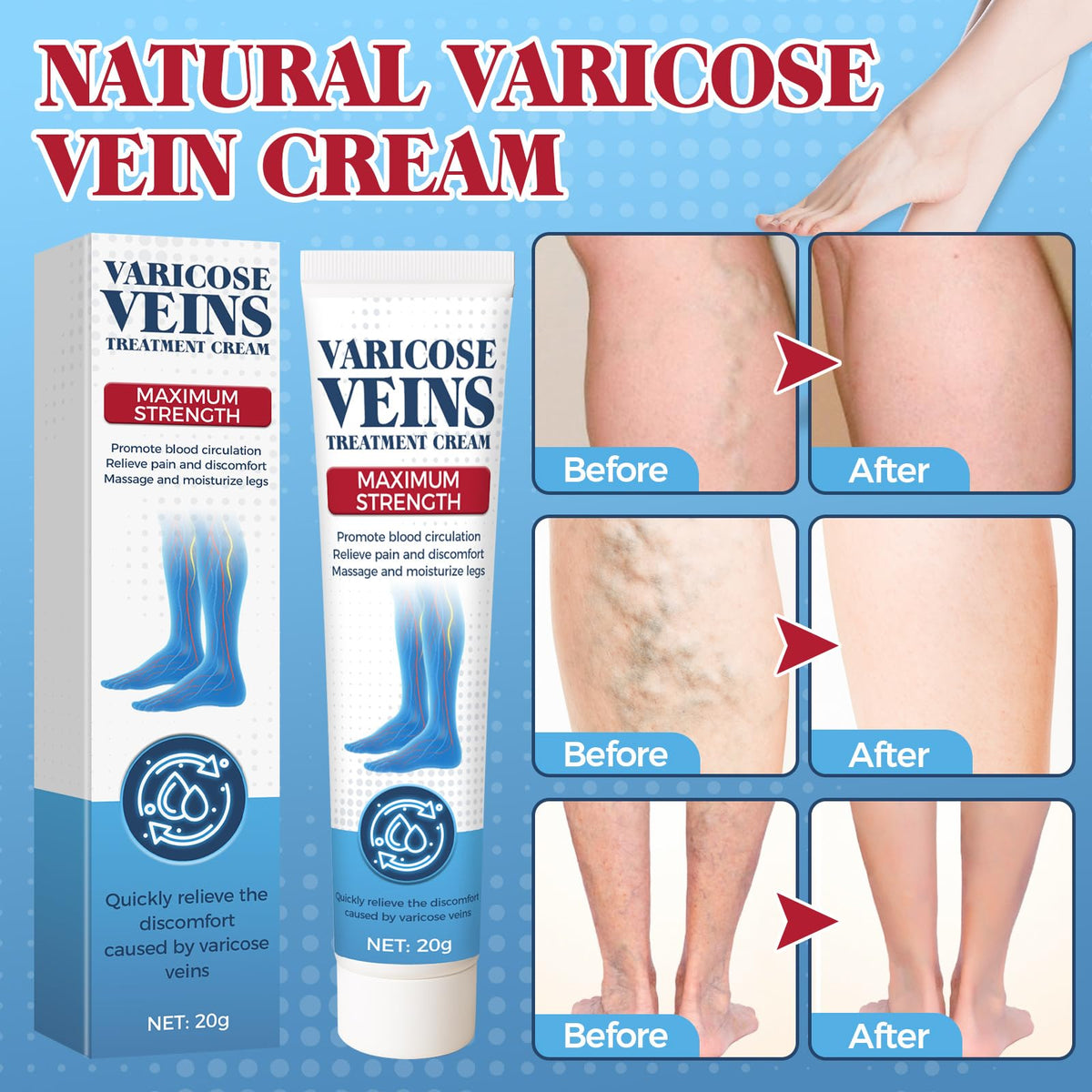Bellisinno cream applied to ankle demonstrating immediate cooling relief