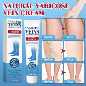 Bellisinno cream applied to ankle demonstrating immediate cooling relief