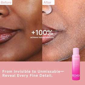 BEOVEA spray applied to cheek revealing fine hair contrast for precise dermaplaning