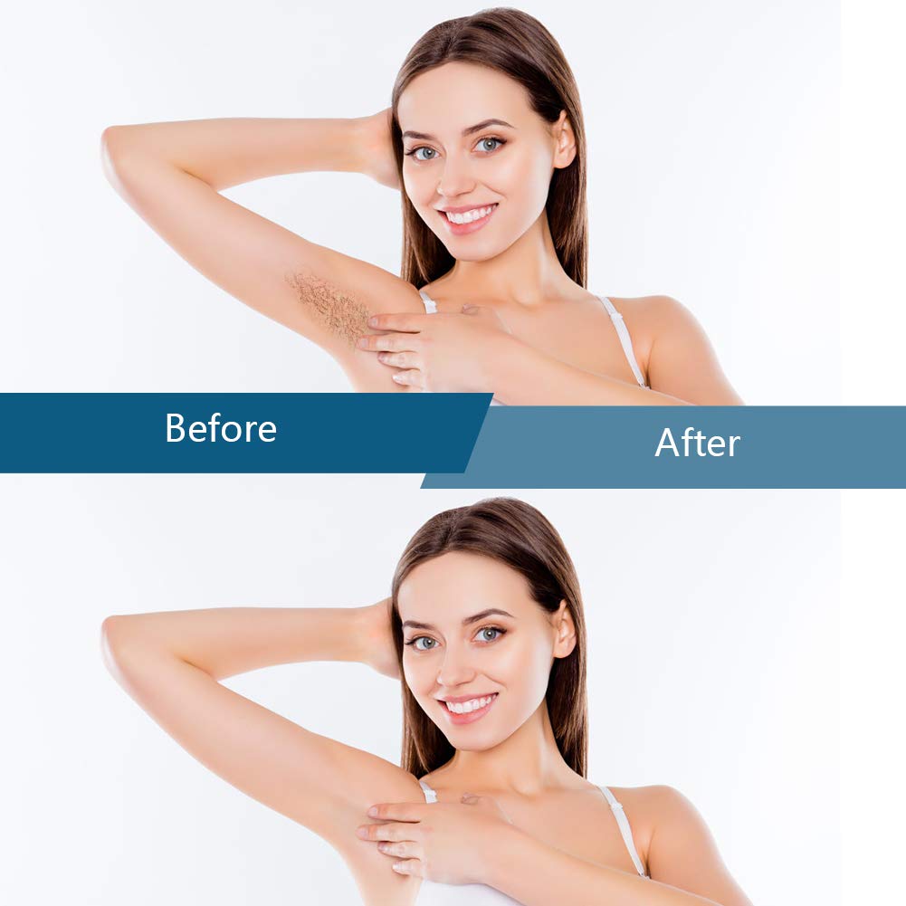 Bestidy used on bikini area demonstrating precise, gentle hair removal
