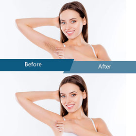 Bestidy used on bikini area demonstrating precise, gentle hair removal