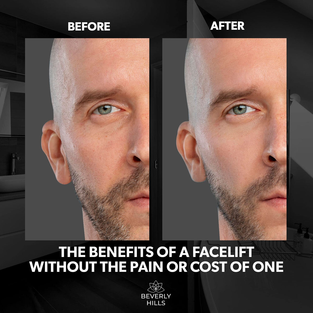 Beverly Hills before and after comparison showing reduced fine lines and firmer skin