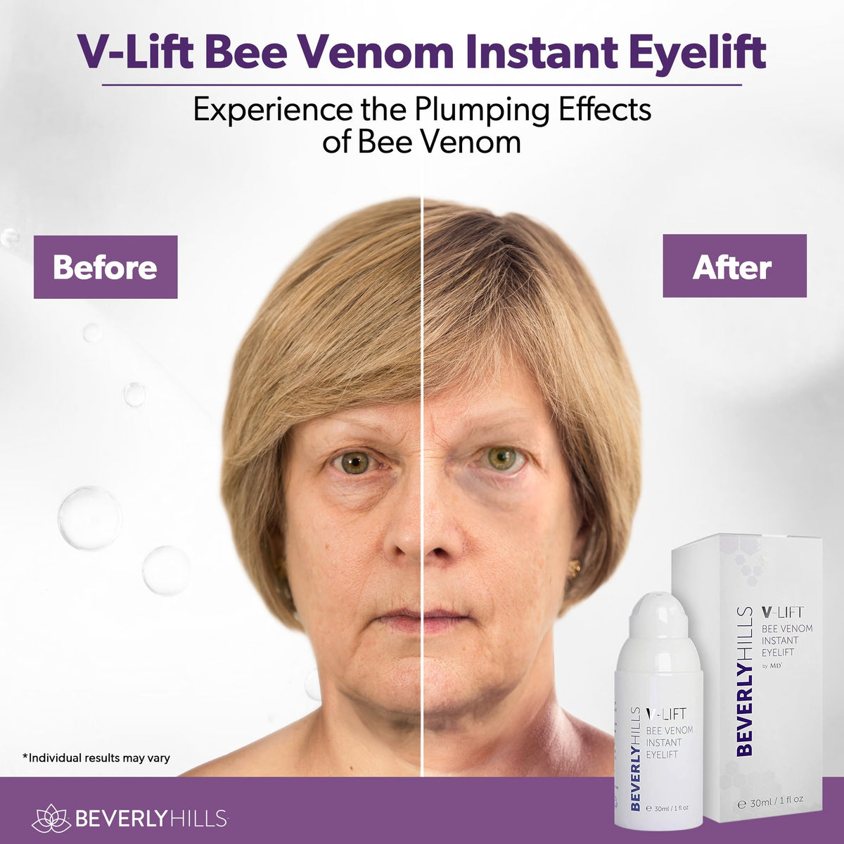 BEVERLY HILLS V-Lift pipette dispensing serum demonstrating controlled application