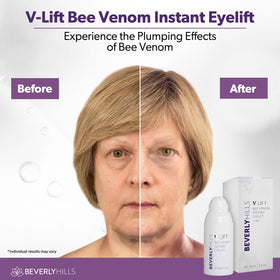 BEVERLY HILLS V-Lift pipette dispensing serum demonstrating controlled application