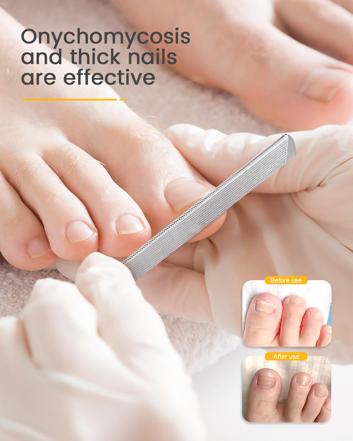 BEZOX detail of dual-ended toenail lifter tip for precise under-nail cleaning