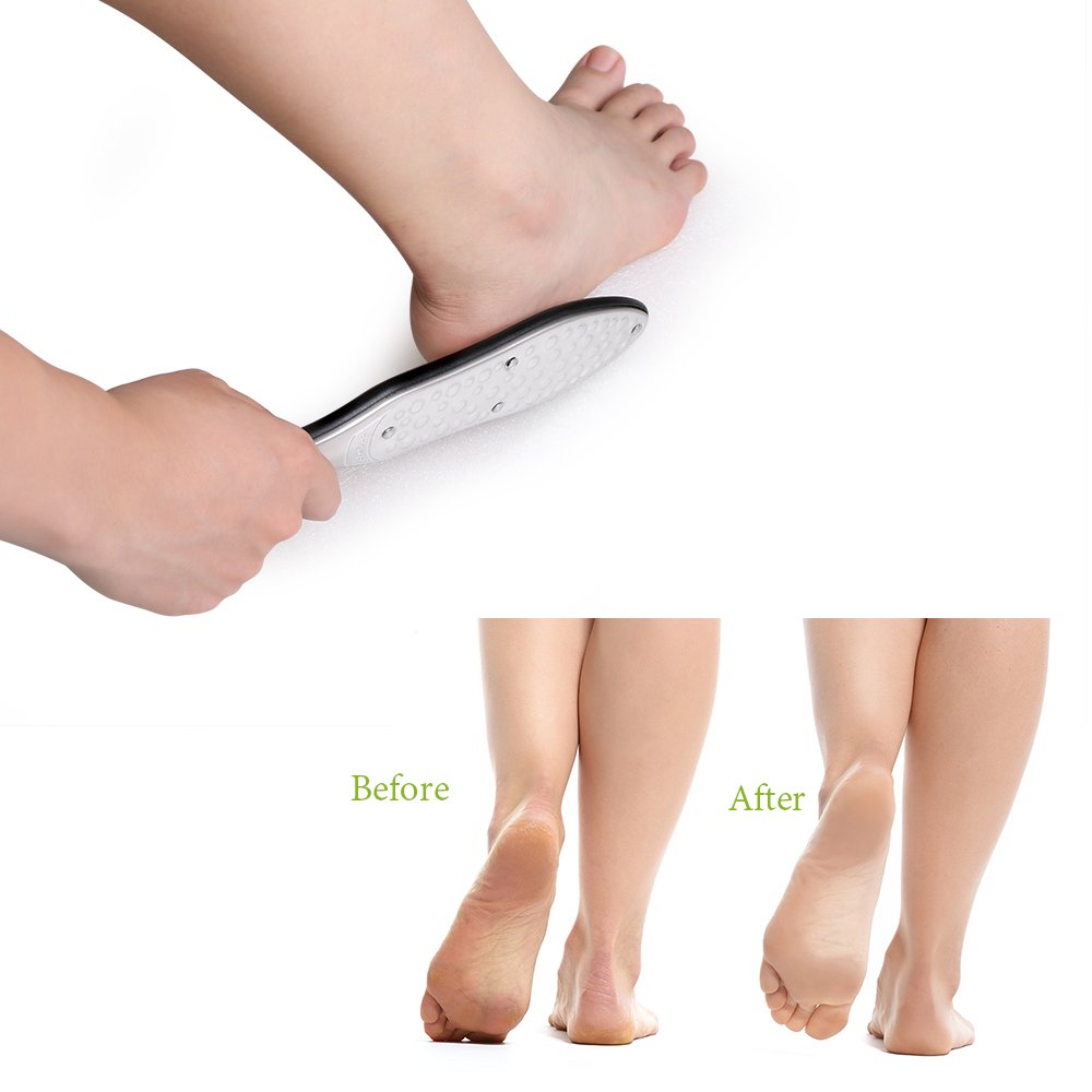BEZOX foot file in use on heel demonstrating fast callus reduction and immediate smoothing