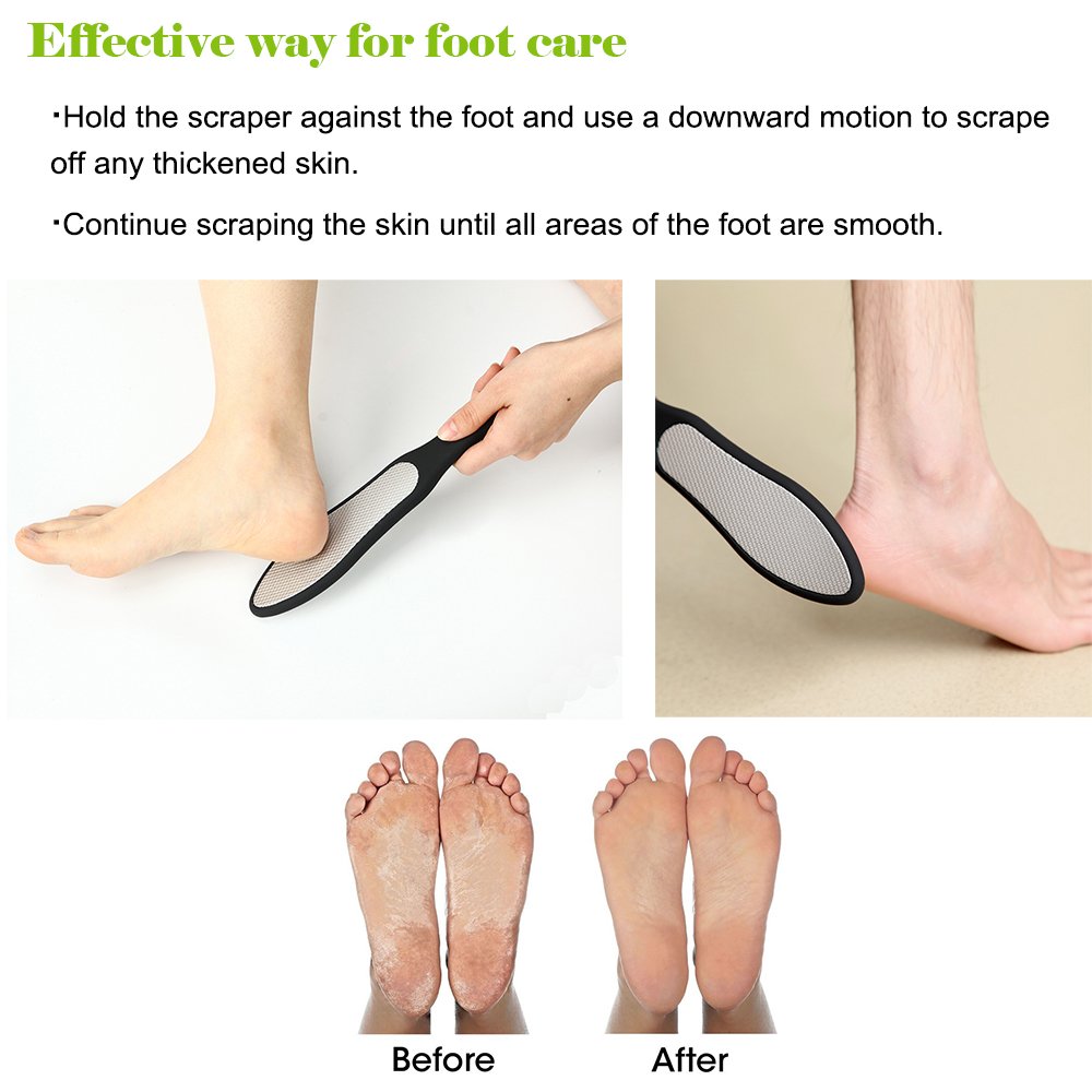 BEZOX foot file in use on heel demonstrating safe callus reduction benefit