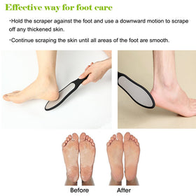 BEZOX foot file in use on heel demonstrating safe callus reduction benefit