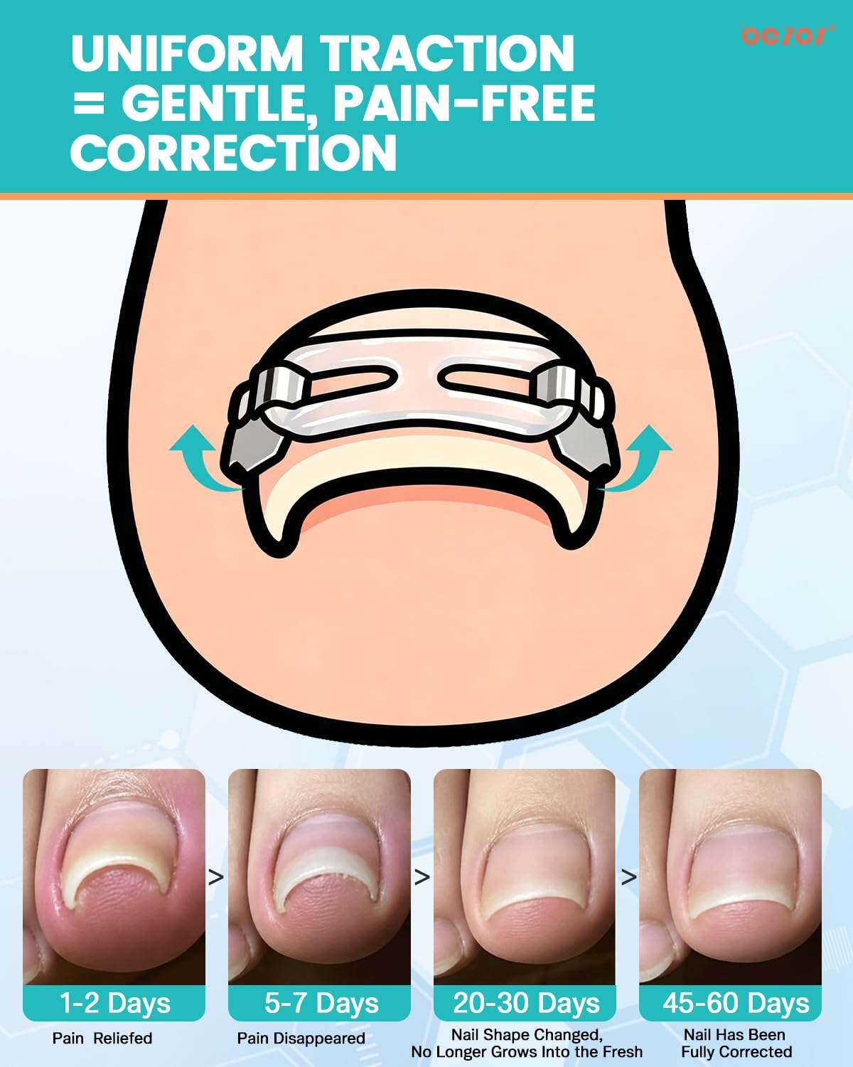 BEZOX traction hooks close-up with visible hooks and secure grip benefit